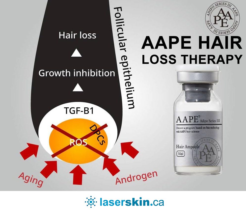 prp hair loss therapy