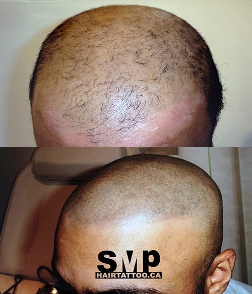 SMP Before and After