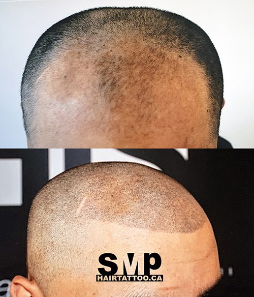 smp before and after 2