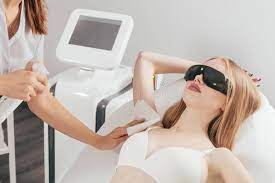 laser hair removal service