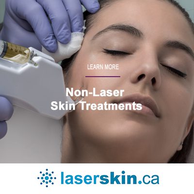 non-laser skin treatments