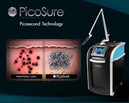 PicoSure Laser for Acne Scars Treatment Toronto