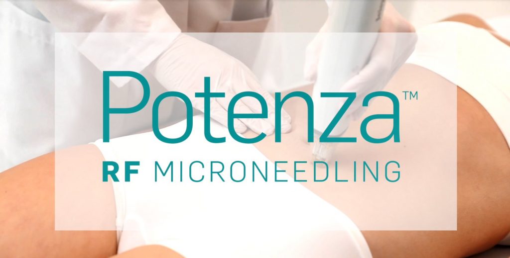 Potenza fine lines and wrinkles treatment Toronto