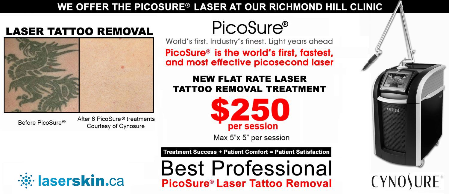 back tattoos and lower back tattoo removal Toronto