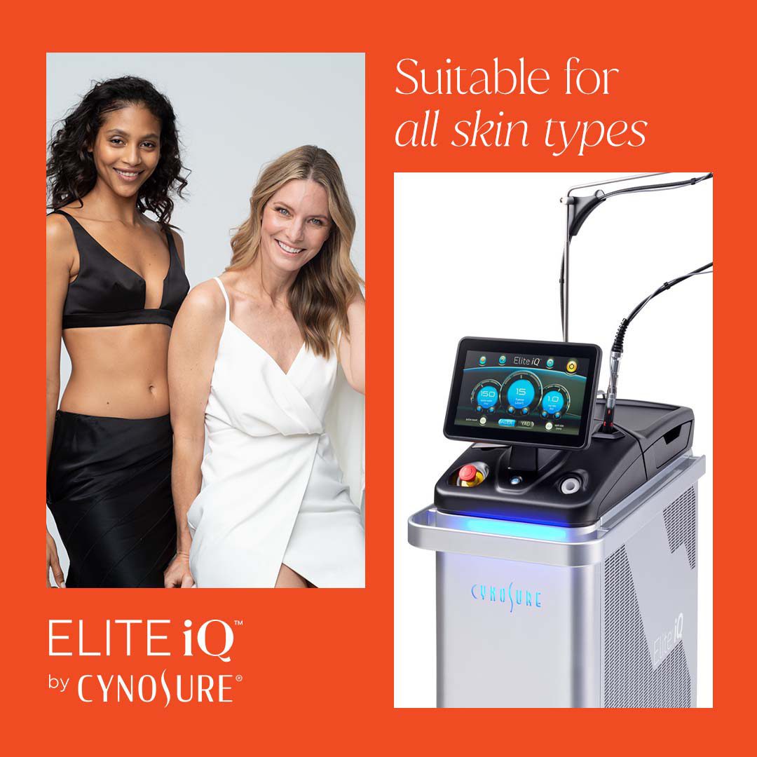 elite iQ laser - best laser hair removal Toronto