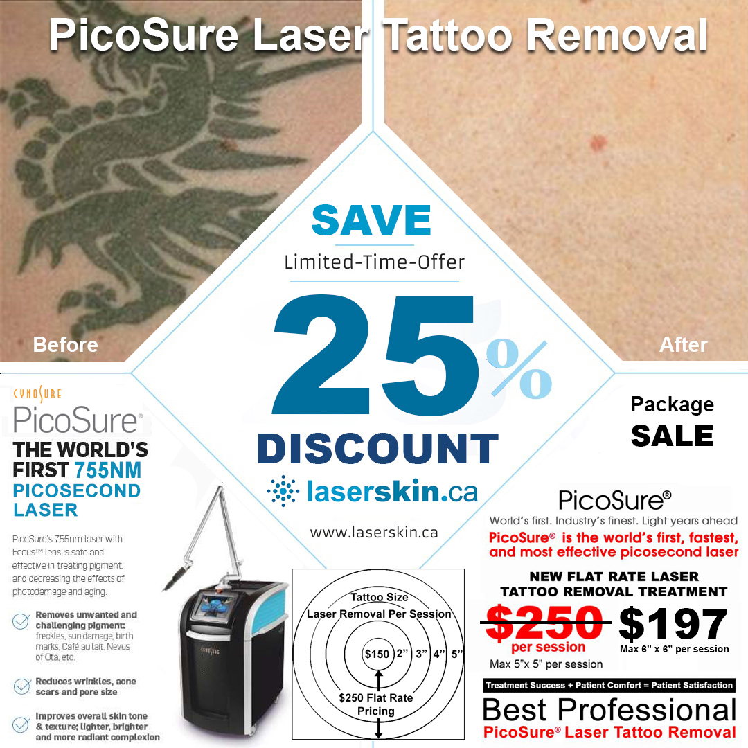 PicoSure Laser Toronto for Laser Tattoo Removal