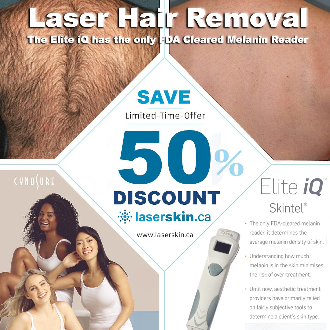 Best Laser Hair Removal Machine Toronto