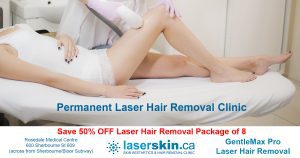 full body laser hair removal Toronto