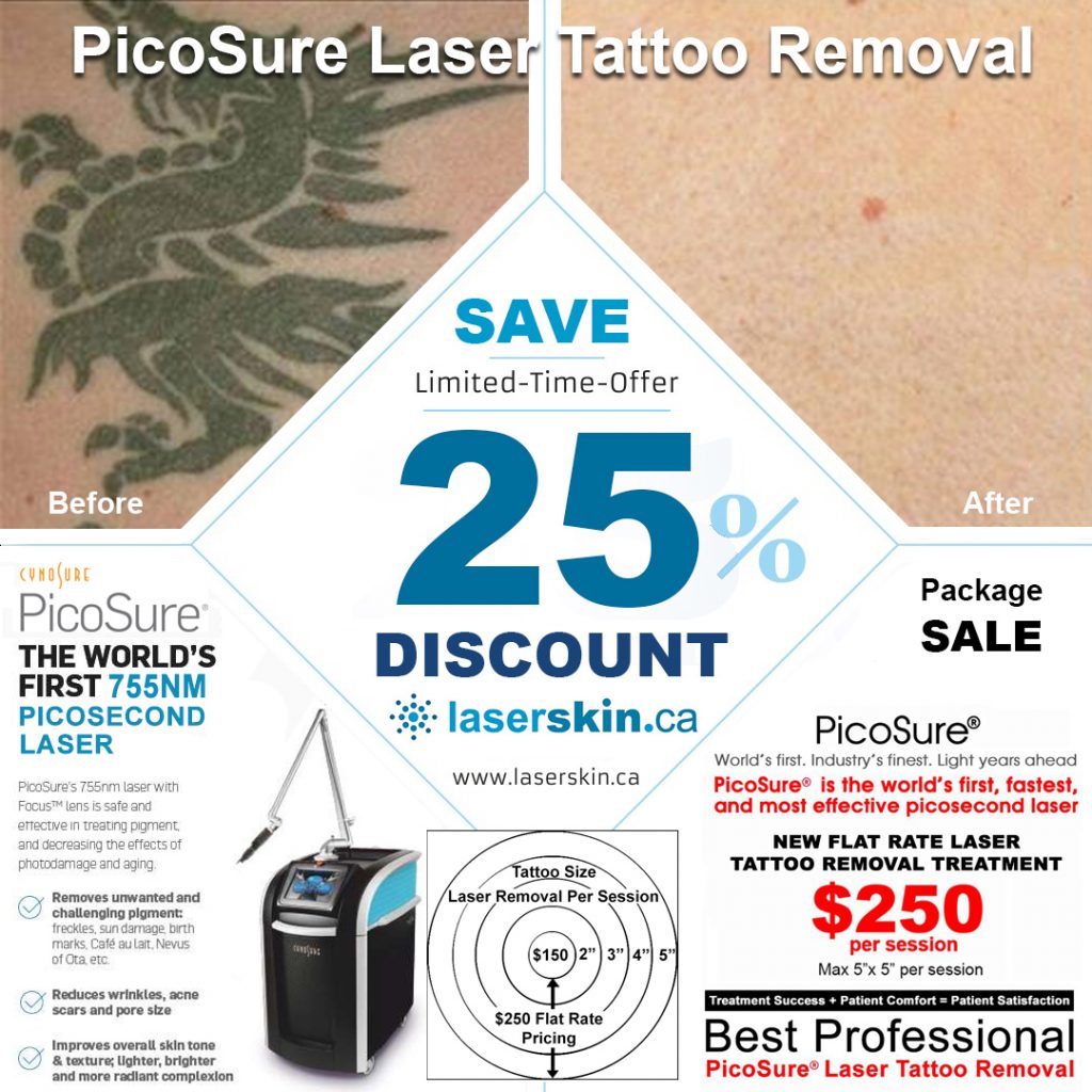 infected tattoos- laser tattoo removal Toronto