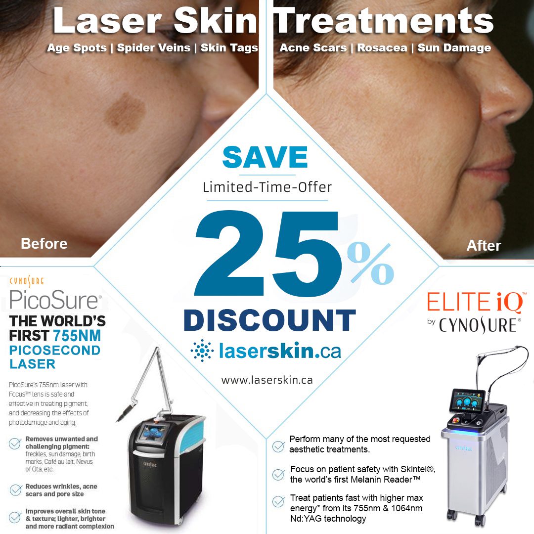 laser skin treatment Toronto