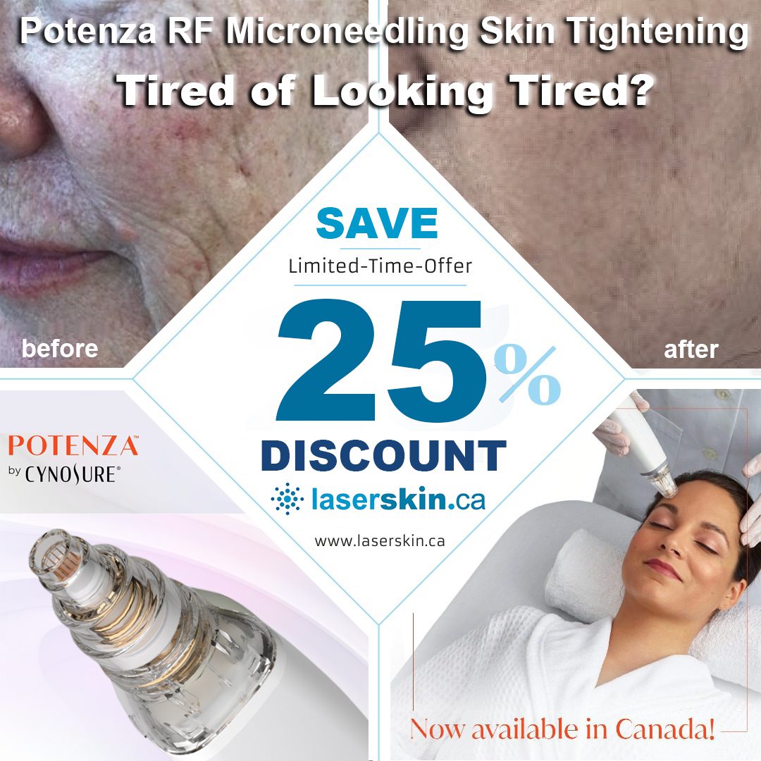 radiofrequency skin tightening Toronto