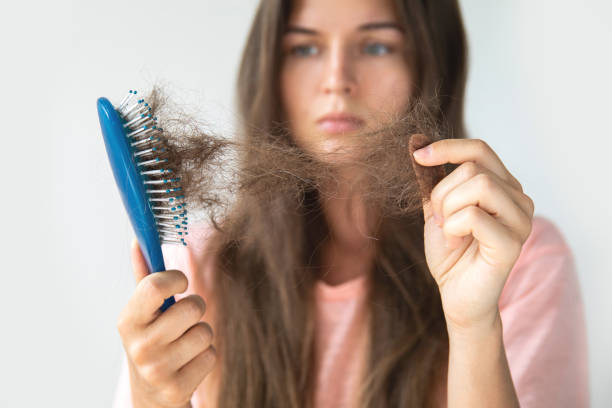 womens hair loss treatment