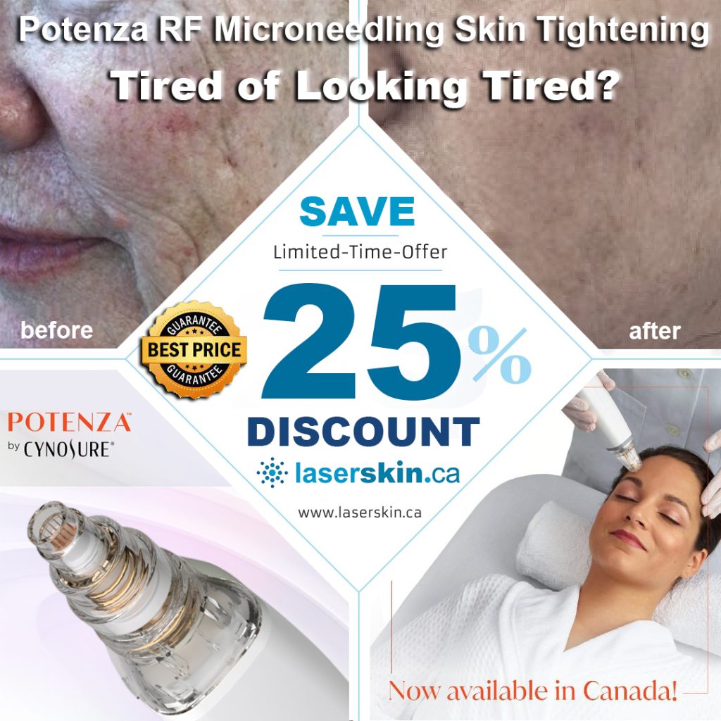 RF Microneedling Toronto | Potenza Microneedling | LASERSKIN