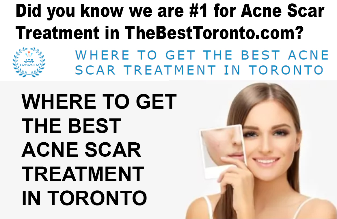best-acne-scar-treatment-Toronto