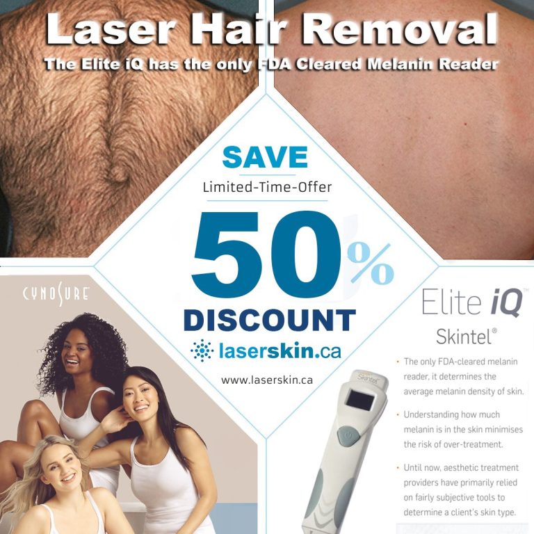 elite iq - elite iq laser - elite iq laser hair removal