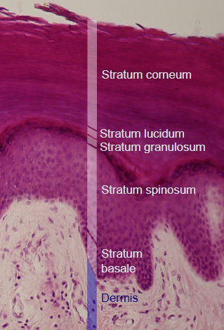 epidermis layers stratum lucidem, stratum granulosum, stratum corneum