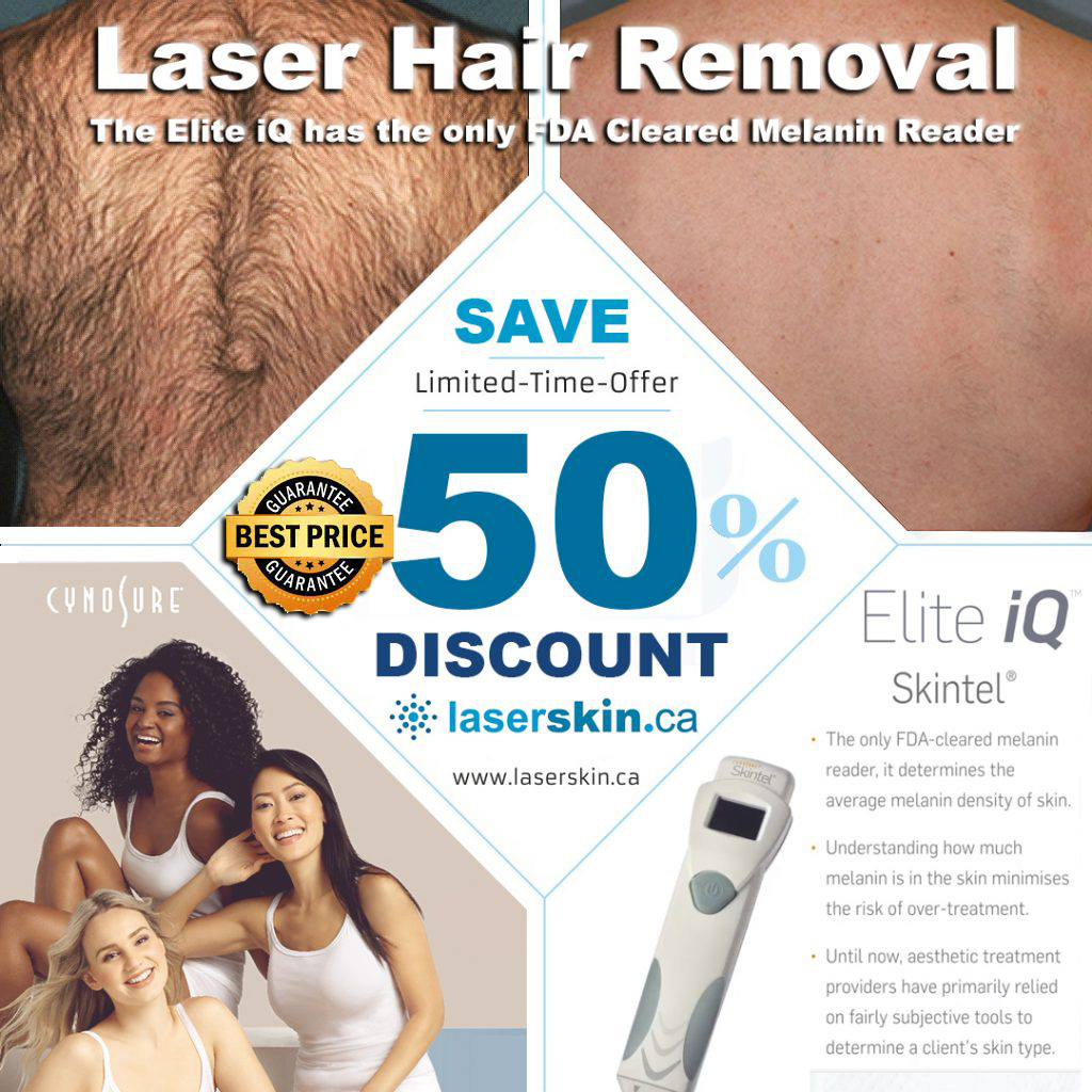 laser hair removal Toronto