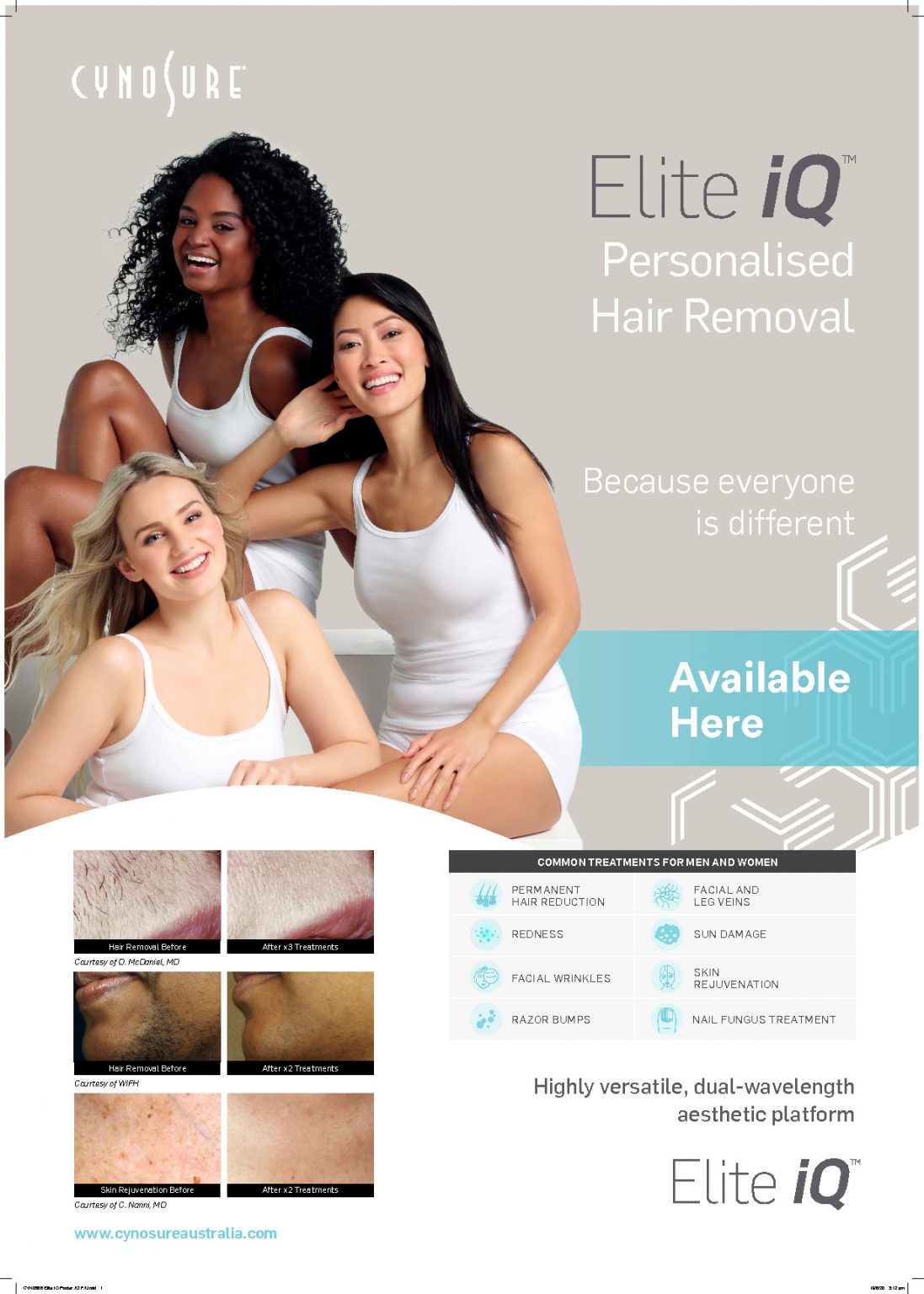 laser-hair-removal-Toronto-Canada-1097x1536