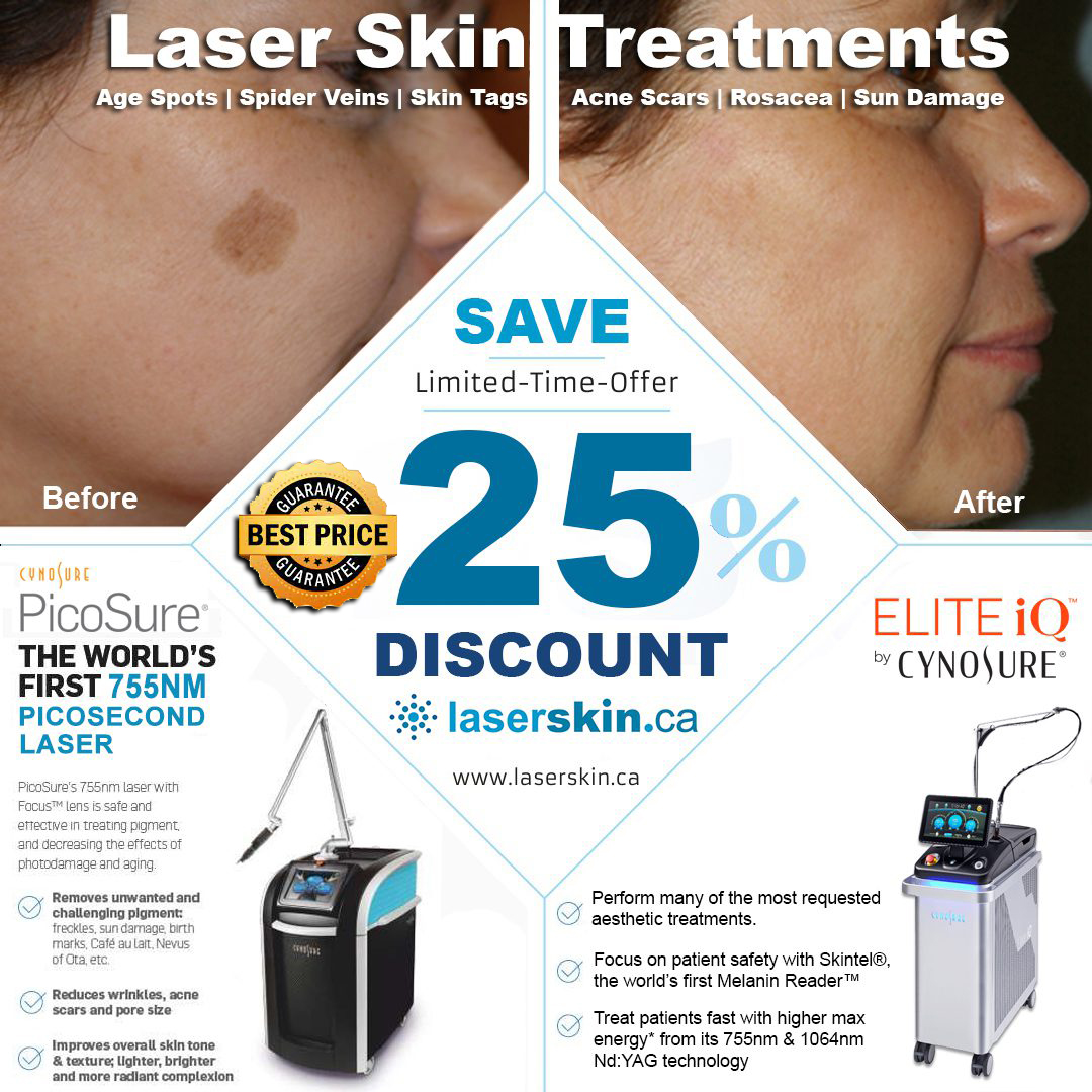 laser skin treatment dark spot removal