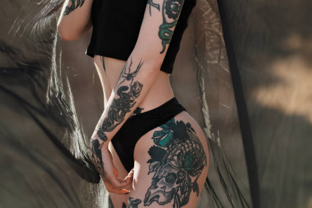 laser tattoo removal Toronto