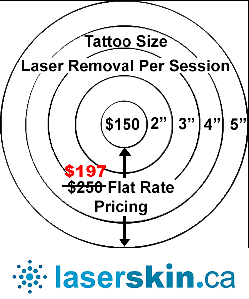 laser-tattoo-removal-cost
