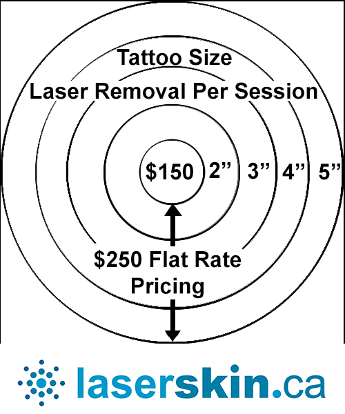 Laser Tattoo Removal Cost Toronto