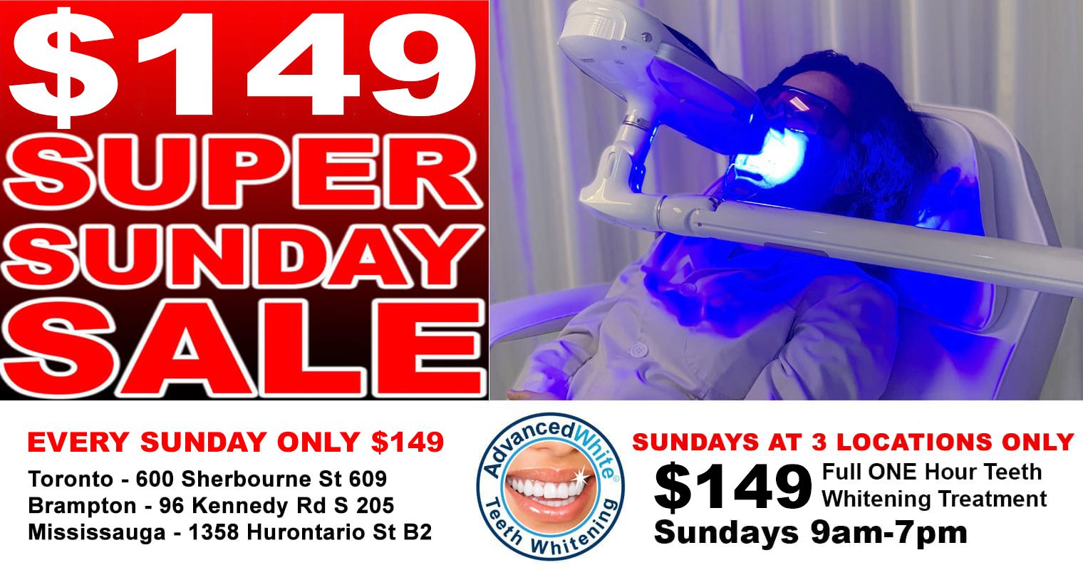 teeth whitening toronto $149 Sunday Special