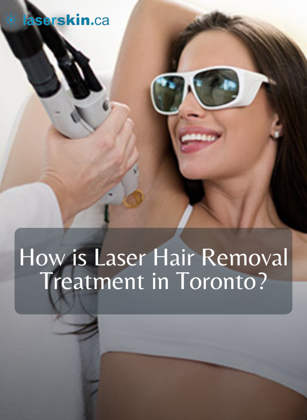 How is Laser Hair Removal Treatment in Toronto?