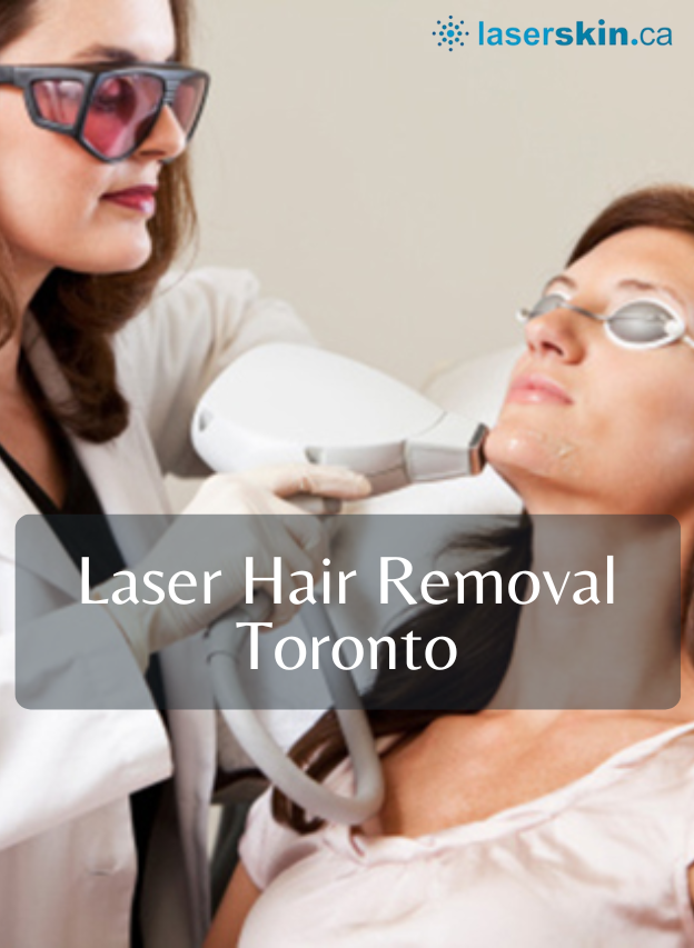 laser hair removal toronto