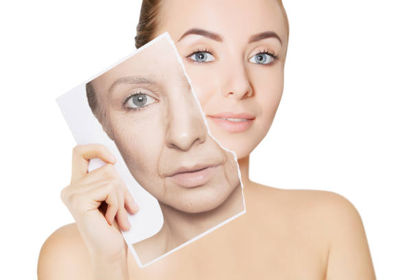 benefits of RF microneedling for your skin
