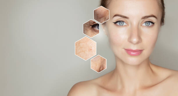 rejuvenation dermatology Toronto