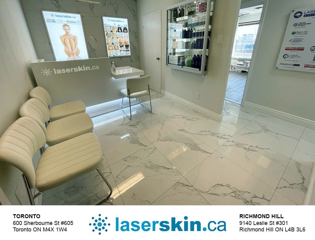 50% OFF Laser Hair Removal Toronto