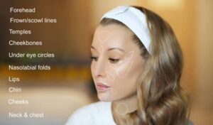 how long does botox last - botox injections