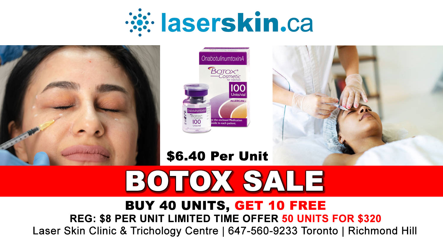 how-long-does-botox-last-promo1