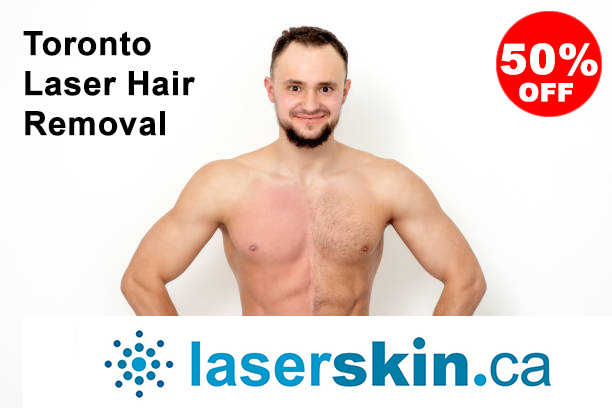 how much is laser hair removal in Toronto