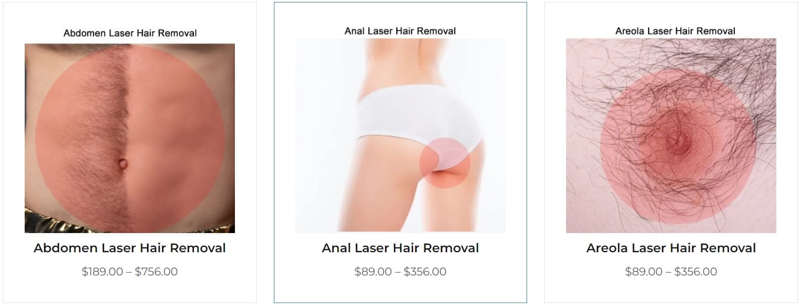 laser hair removal cost