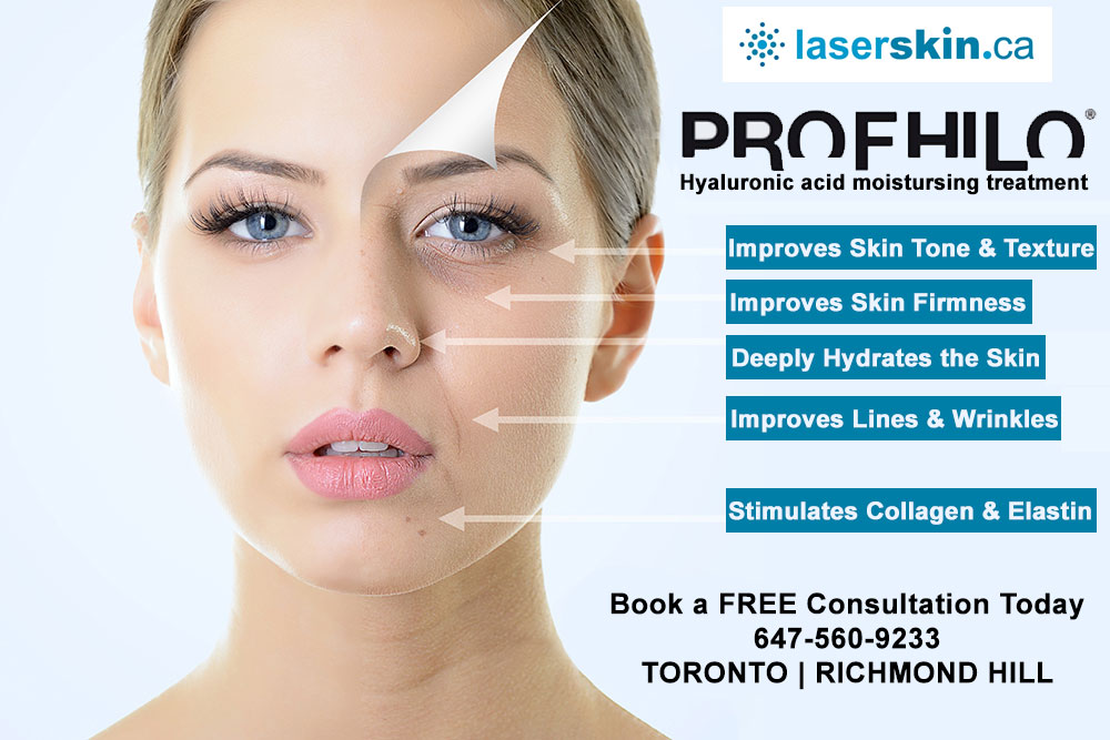 What is Profhilo? Learn About this Unique Injectable Anti-Aging Treatment