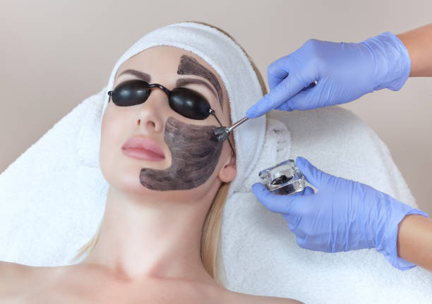 laser skin resurfacing near me Toronto