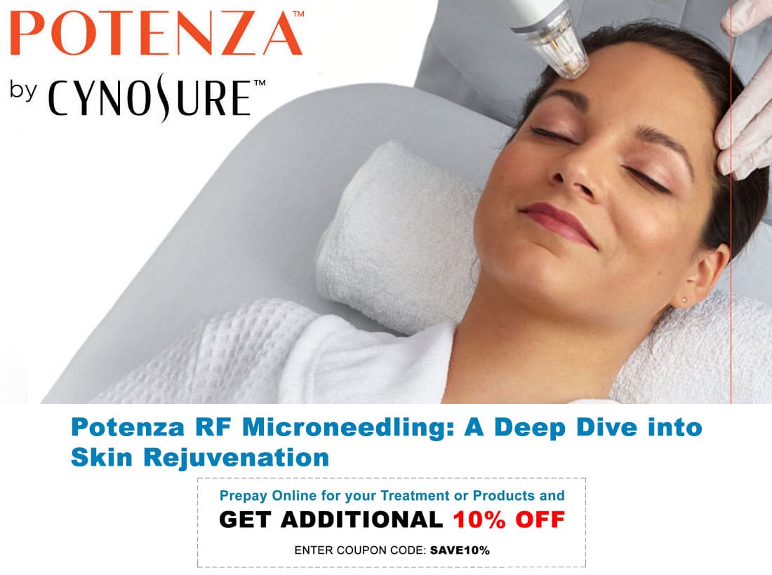 Pricing For Potenza RF Microneedling Packages