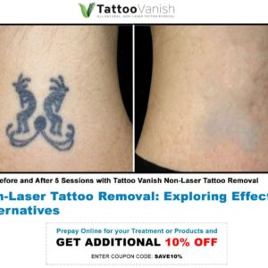non laser tattoo removal before and after Tattoo Vanish