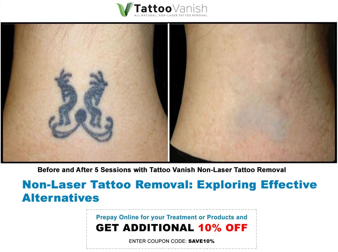 Tattoo removal: why use a medically-trained professional? | ENRICH