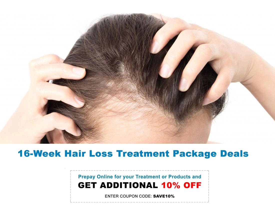 Pricing for 16-Week Hair Loss Treatment Packages