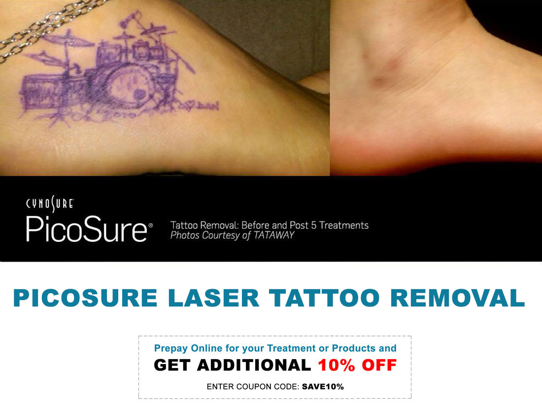 Permanent Tattoo Removal in Ashburn, Virginia - Northern VA Med Spa