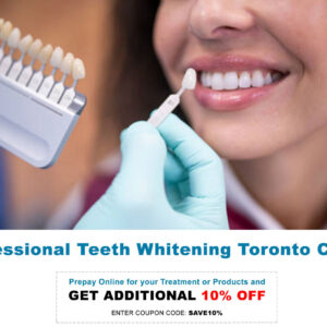 professional-teeth-whitening-toronto-clinic