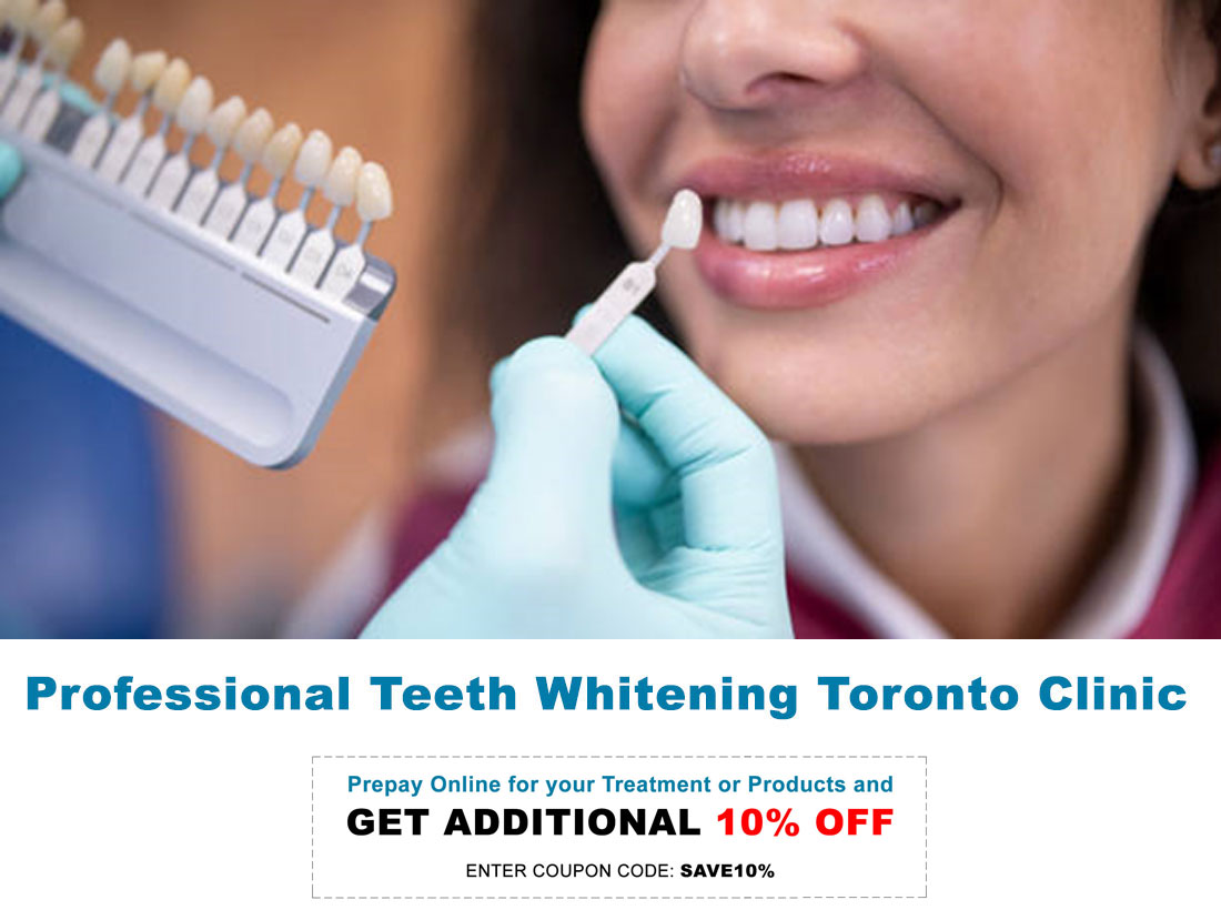 Professional Teeth Whitening Toronto Clinic