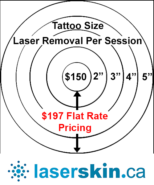 tattoo removal cost Toronto