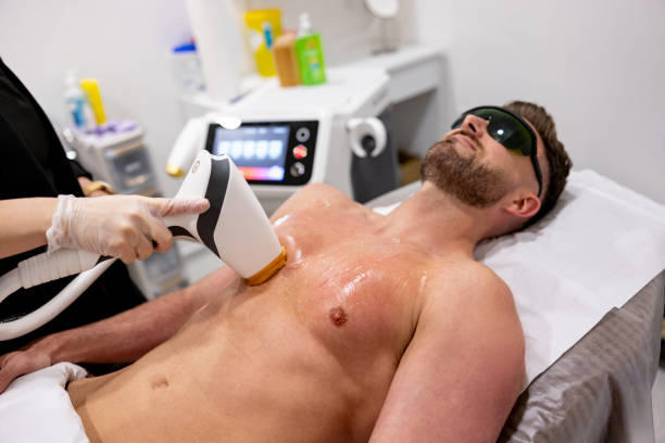 The Ultimate Guide to the Best Laser Hair Removal Methods and Machines