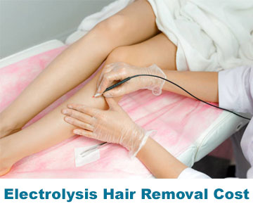 electrolysis-hair-removal-cost-electrolysis-Toronto