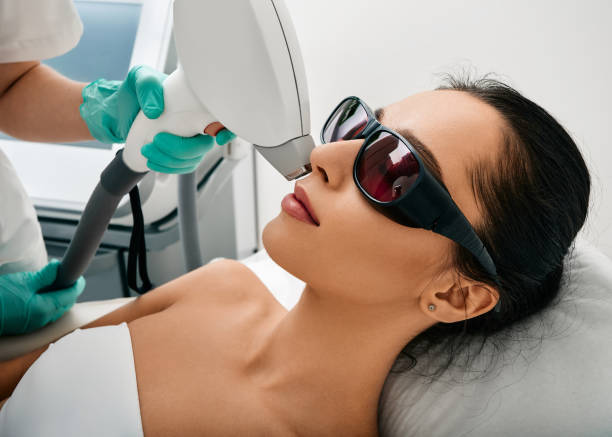 facial laser treatment near me - facial laser treatment toronto