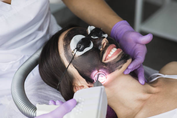 Facial Laser Treatment Near Me: A Comprehensive Guide